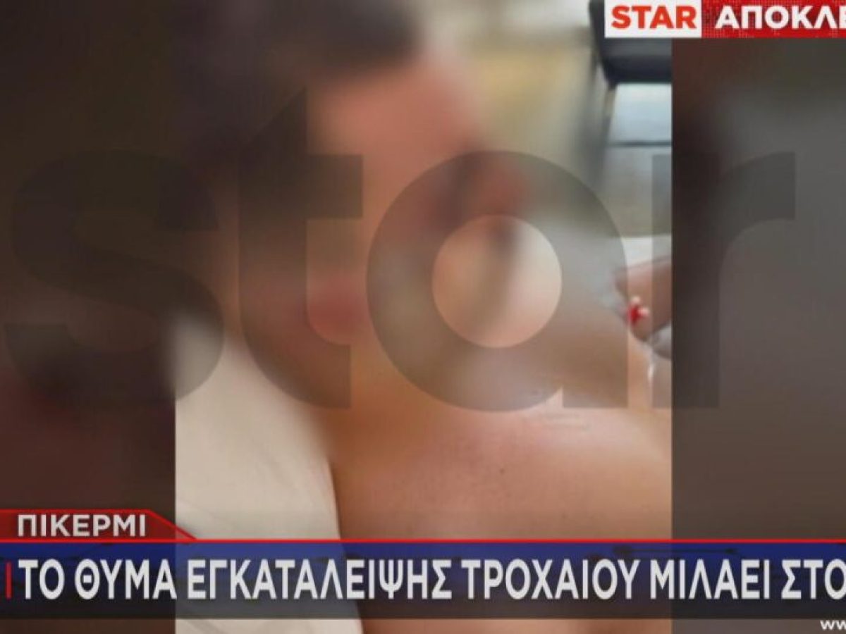 Συγκλονίζει ο 22χρονος που παρασύρθηκε στο Πικέρμι: «Έχω ανυπόφορους πόνους, το αυτί μου είναι κομμένο»