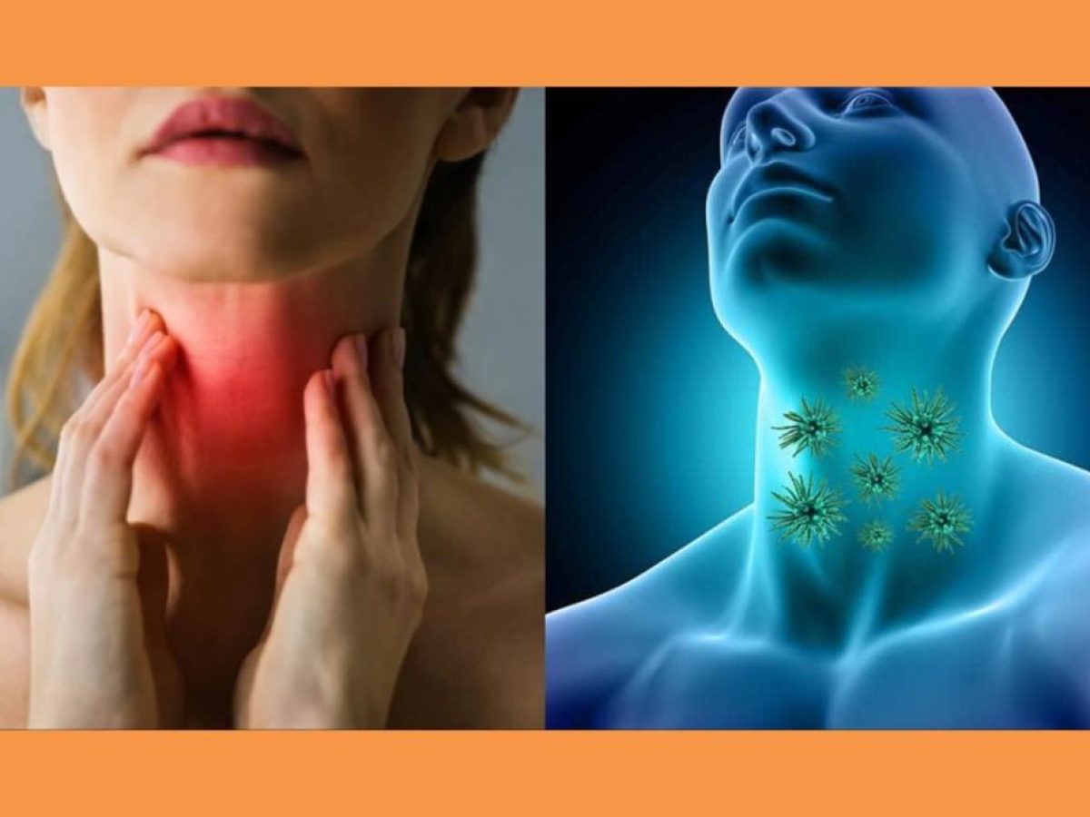 SOS SOS ΜΕΓΑΛΗ ΠΡΟΣΟΧΗ «Μυστηριώδης ιός του λαιμού»