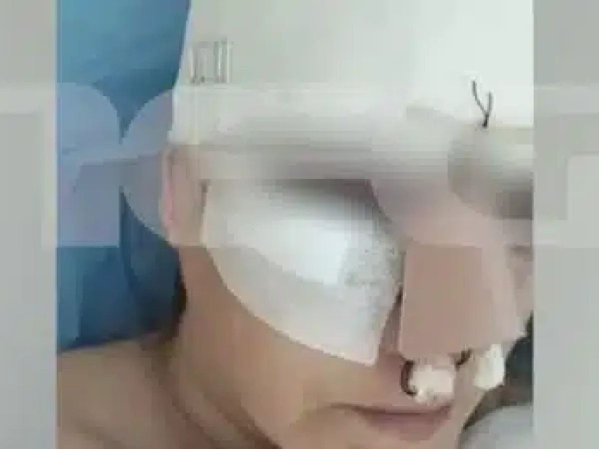 Εμπορικό Κέντρο Θεσσαλονίκης: «Σπασμένη μύτη, πλευρό, πάνω από 100 ράμματα»