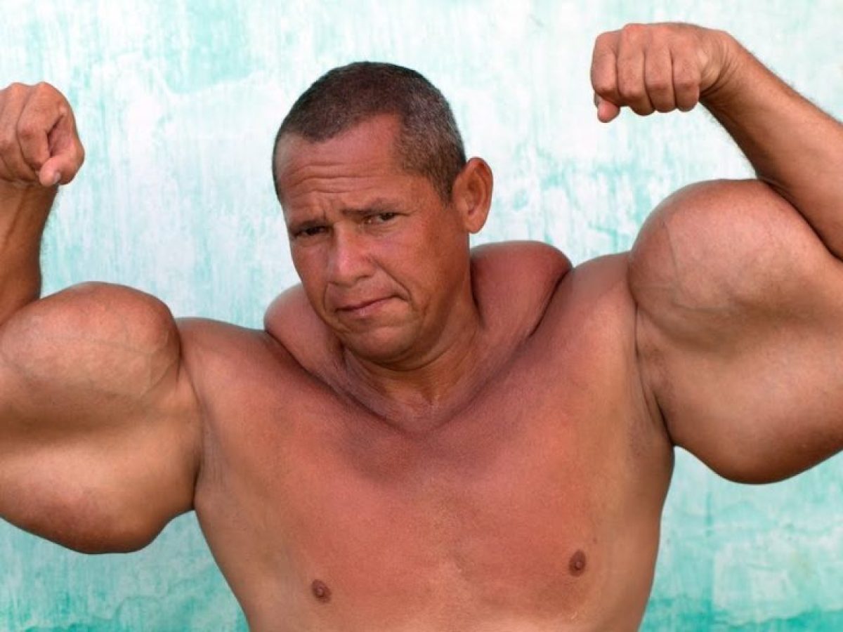 Ρεσίφε: Πέθανε ο Βραζιλιάνος «Ποπάι» – Φούσκωνε τα μπράτσα του με ορυκτέλαιο