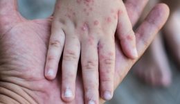 se-exarsi-o-ios-koxaki