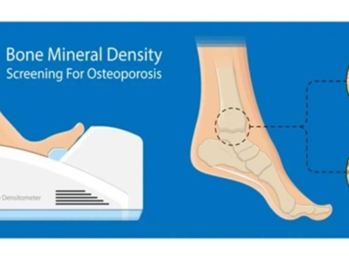Δωρεάν προληπτικός έλεγχος οστικής πυκνότητας στο Ναύπλιο