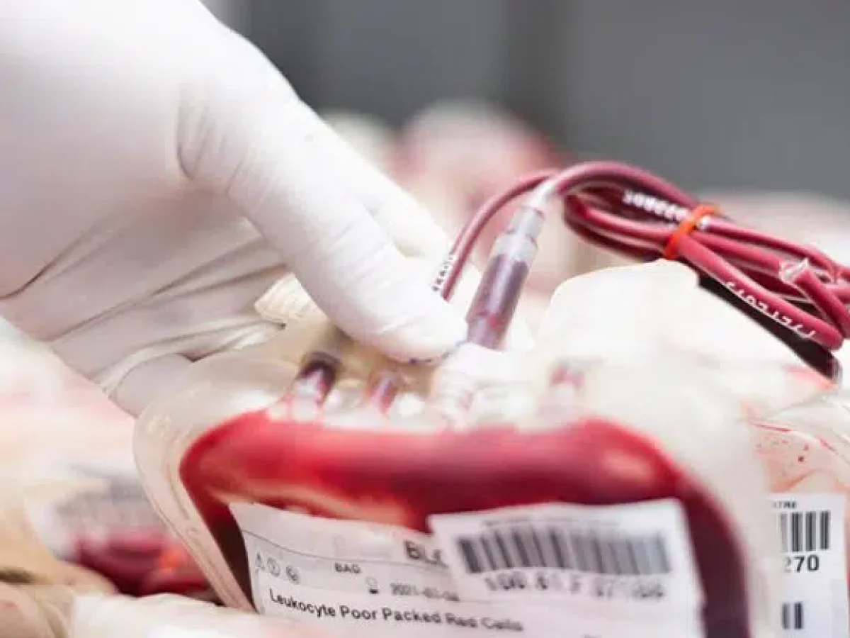 Έκκληση για αίμα από την Ελληνική Ομοσπονδία Θαλασσαιμίας – 55 ασθενείς σε καθεστώς αναβολής μεταγγίσεων στο Νοσοκομείο του Ρίου