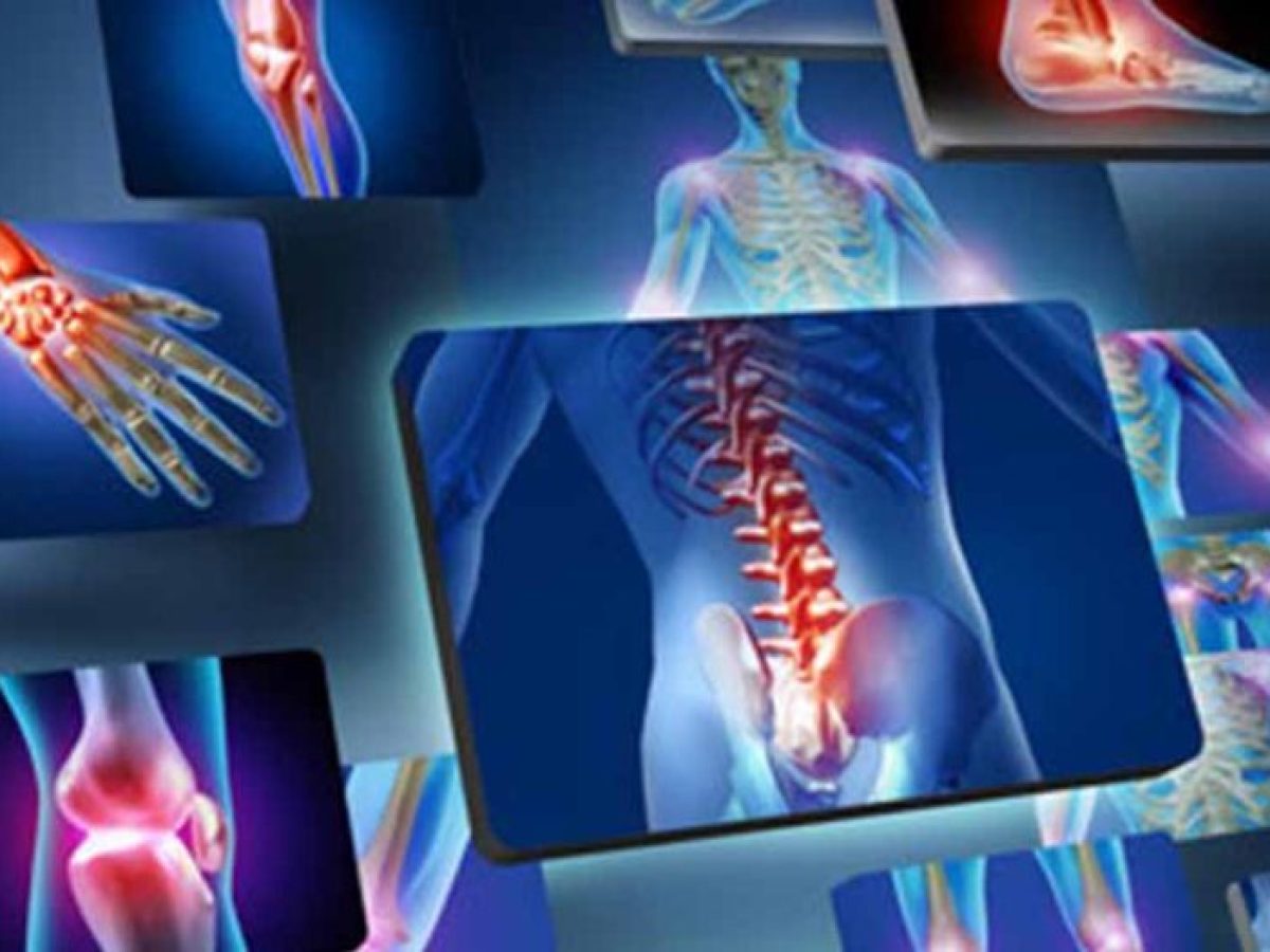 Ενημερωτική oμιλία στο Ναύπλιο για την οστεοπόρωση και την πρόληψη πτώσεων