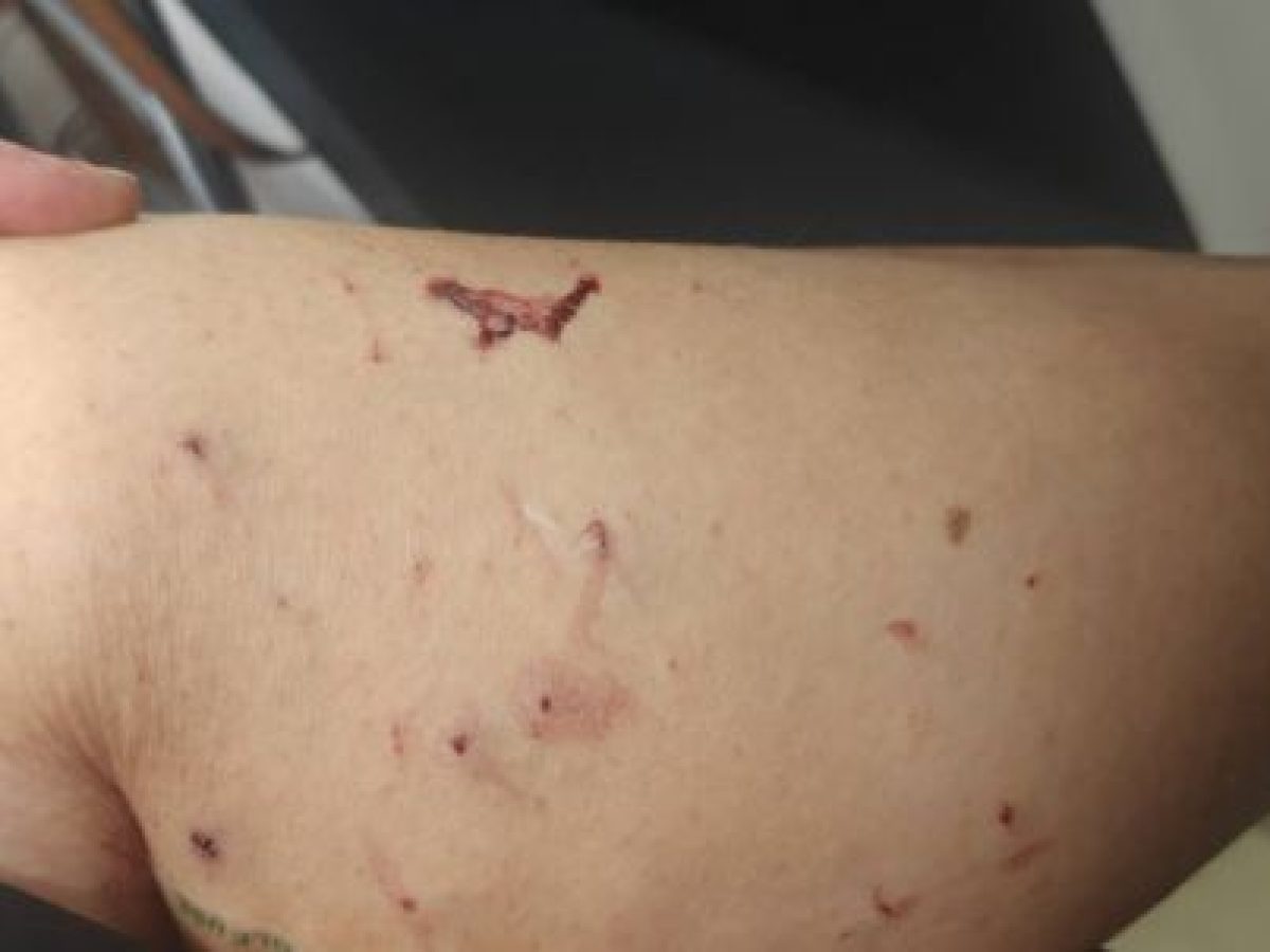 Καταγγελία για επίθεση γάτας σε γυναίκα στην Τρίπολη