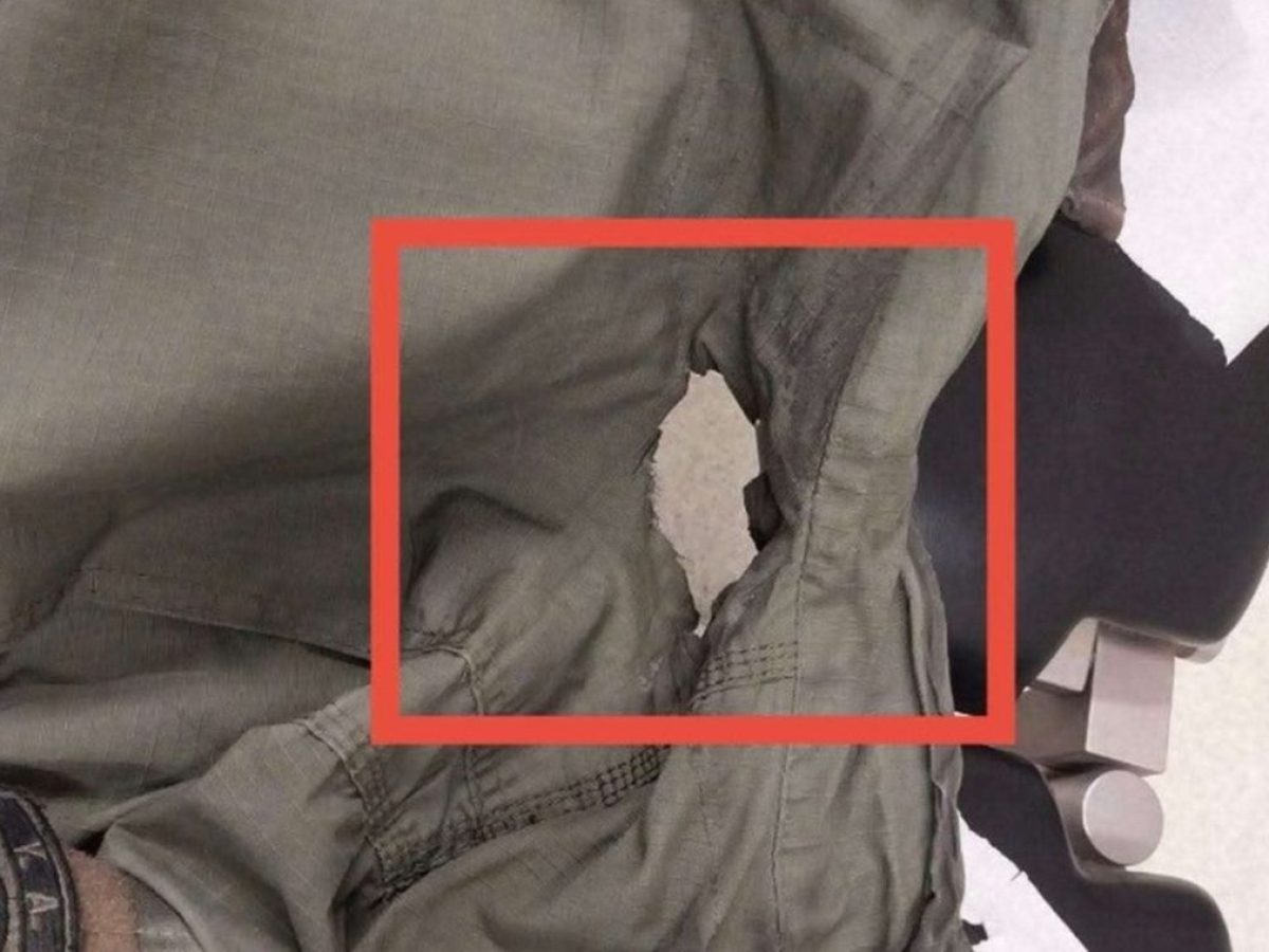 Θεσσαλονίκη: Μολότοφ τρύπησε τη στολή αστυνομικού στα επεισόδια του ΑΠΘ (ΦΩΤΟ)