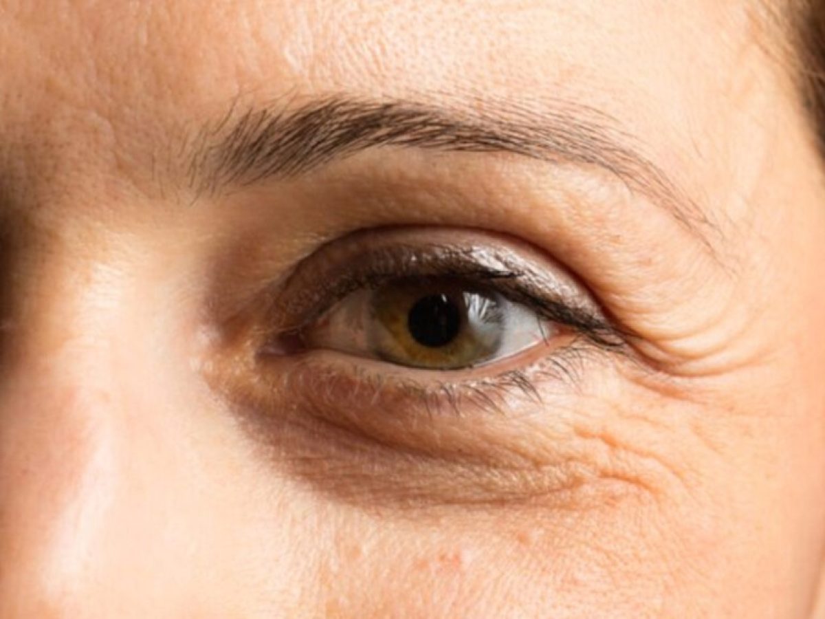 Βλέμμα Νεότητας: 5 τρόποι να μειώσεις τις λεπτές γραμμές