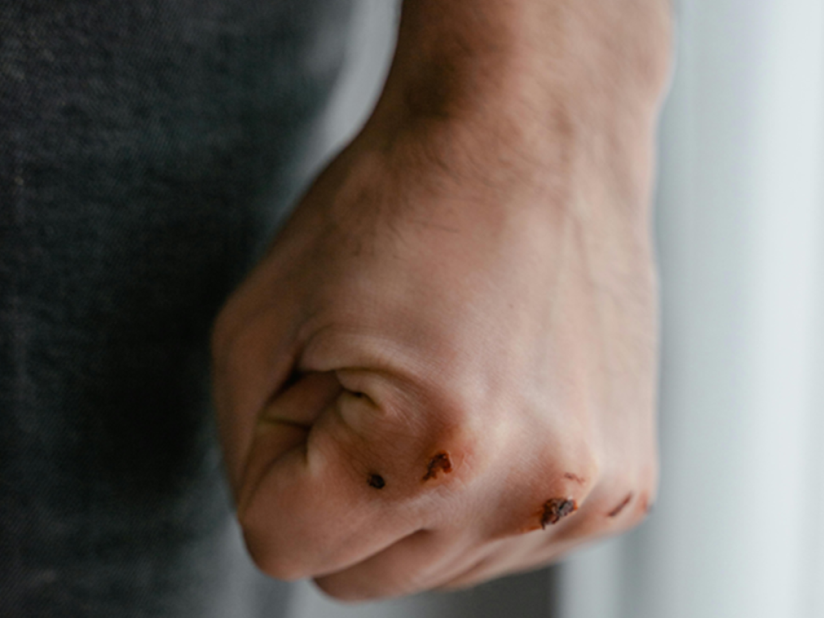 Βόλος: Θύμα άγριου ξυλοδαρμού και εκβιασμού 15χρονος για ένα «like»