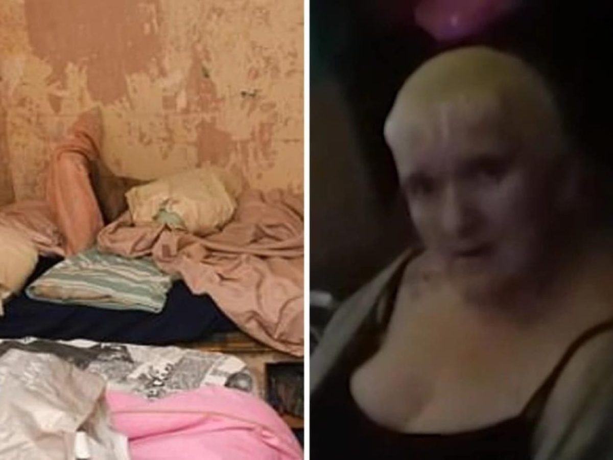 Φρίκη! Γυναίκα κρατούσε σκλάβα άλλη γυναίκα για 25 χρόνια – Της έριχνε υγρό πιάτων και χλωρίνη στο πρόσωπο