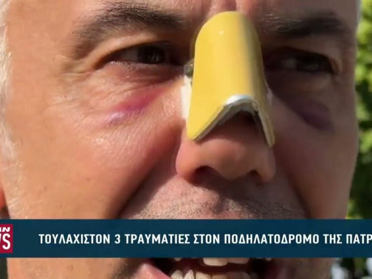 Τουλάχιστον 3 τραυματίες στον ποδηλατόδρομο της Πάτρας
