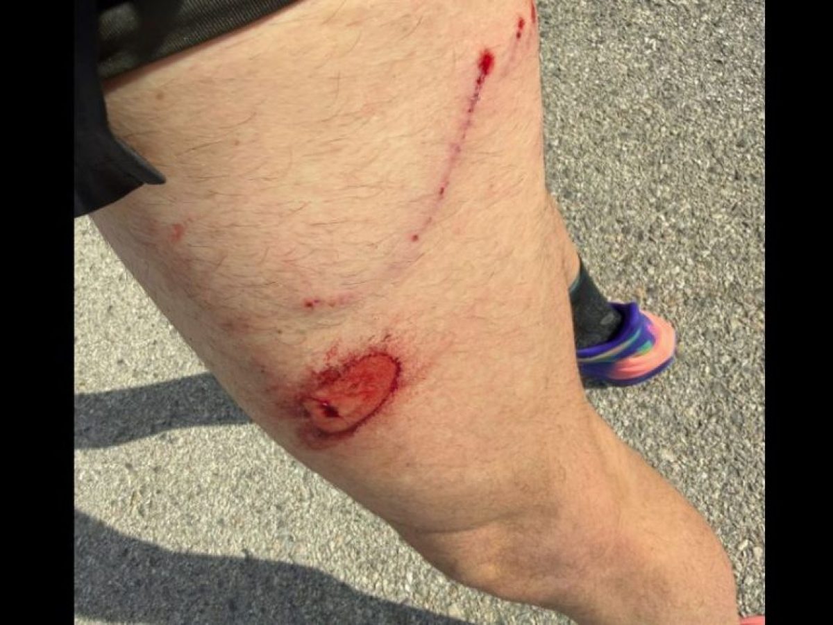 Σχινιάς: Αδέσποτος σκύλος επιτέθηκε και δάγκωσε πολίτη που έτρεχε κοντά στο Κωπηλατοδρόμιο